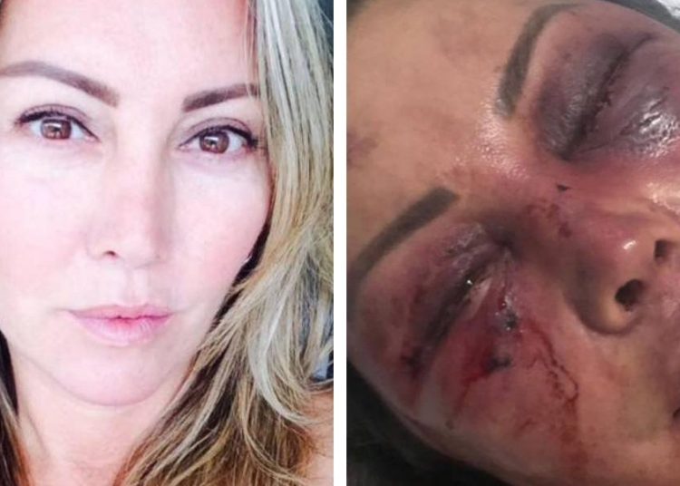 A una mujer le dan una gran paliza por 4 horas en su primera cita