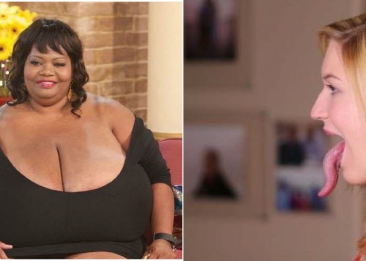 Personas con partes extremadamente grandes de  su cuerpo