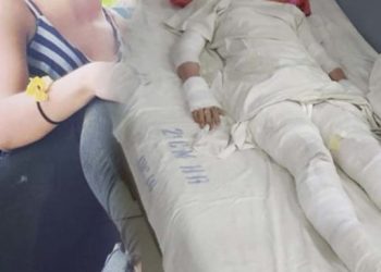 Ella es la guapísima Rosita que fue destrozada en mejicanos tras la explosión de cilindro de gas