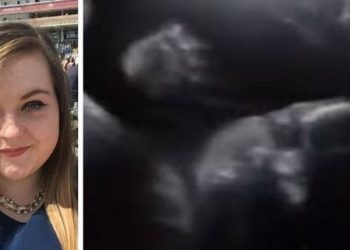 Bebé saluda a sus padres desde el útero cuando aplicaban el ultrasonido