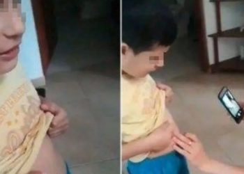 Niño se traga un imán y critican a su madre por lo primero que hizo