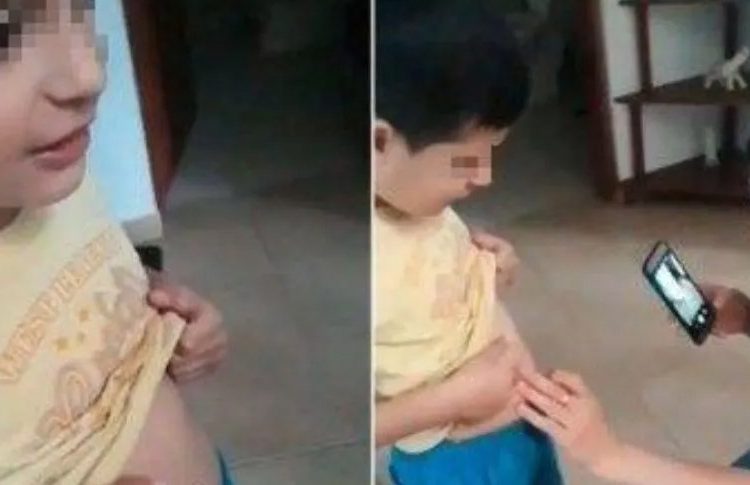 Niño se traga un imán y critican a su madre por lo primero que hizo