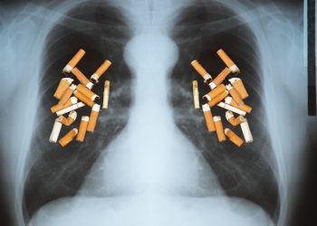 Quería donar sus pulmones, pero estaban negros tras fumar durante 30 años