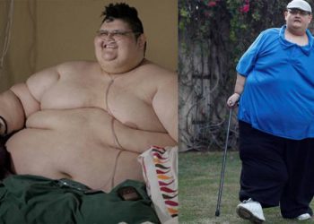 El hombre más obeso del mundo pierde 300 kilos, ahora Juan Pedro ya camina, se mueve por sí solo