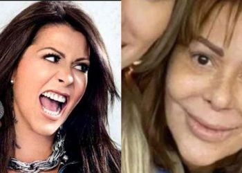 La increíble evolución del rostro de Alejandra Guzmán a largo de los años