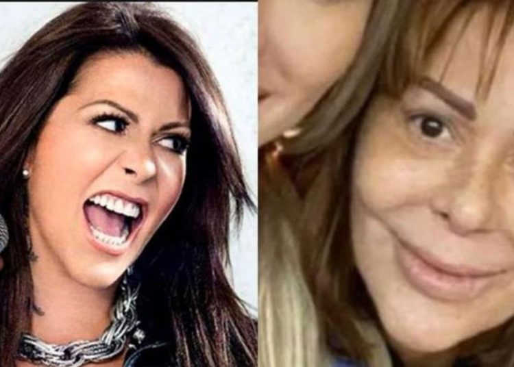 La increíble evolución del rostro de Alejandra Guzmán a largo de los años