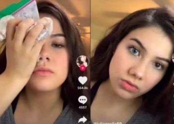 Jóvenes se colocan bolsa con detergente en los ojos para cambiarlos de color