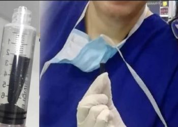 Médicos extraen un tapón de lapicero del pulmón de un niño