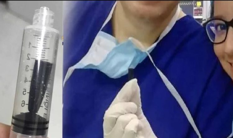 Médicos extraen un tapón de lapicero del pulmón de un niño