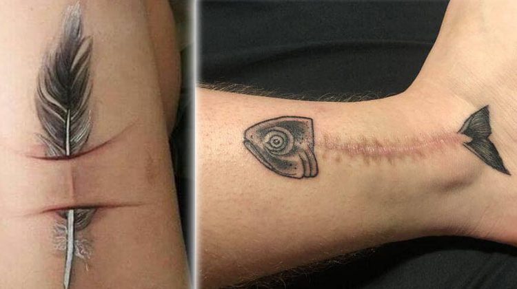 Tatuajes sobre las cicatrices; esa es la nueva tendencia