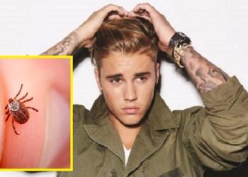 Justin Bieber confiesa tener enfermedad transmitida por garrapatas