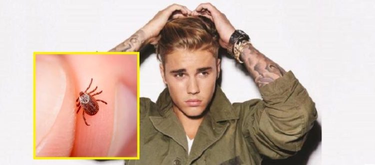 Justin Bieber confiesa tener enfermedad transmitida por garrapatas