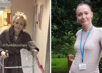 El antes y el después de personas que han superado su adicción a las drogas