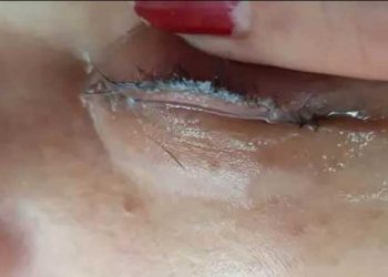 Mujer quería extensiones de pestañas y le terminaron pegando los ojos