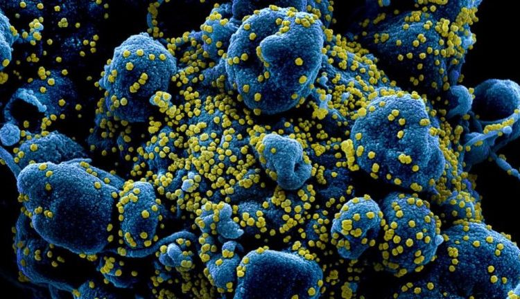 Captan al coronavirus atacando células humanas