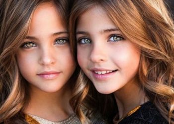 Estas son las dos gemelas consideradas las más guapas del mundo