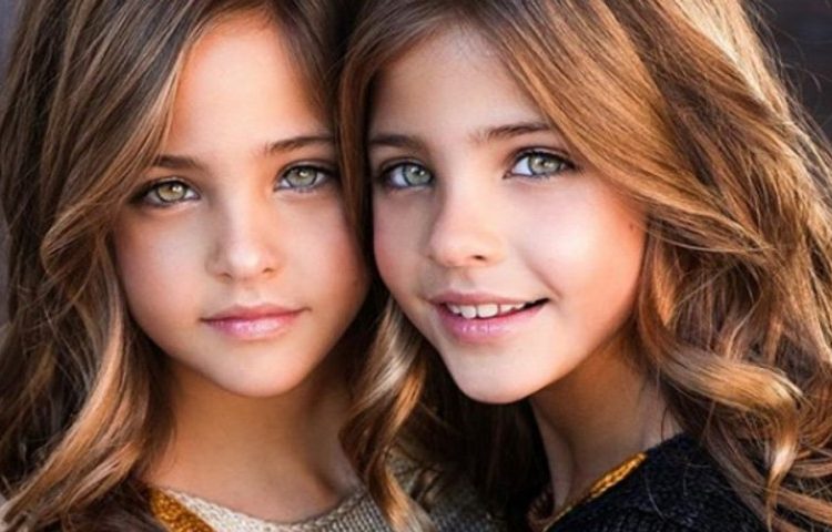 Estas son las dos gemelas consideradas las más guapas del mundo