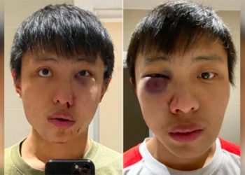 Joven asiático es brutalmente golpeado en Londres: ‘No quiero tu coronavirus en mi país’