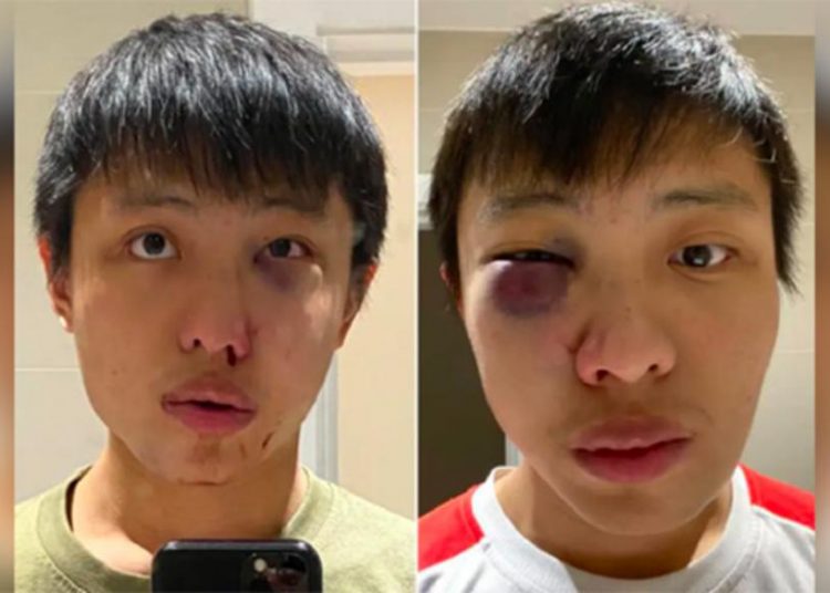Joven asiático es brutalmente golpeado en Londres: ‘No quiero tu coronavirus en mi país’