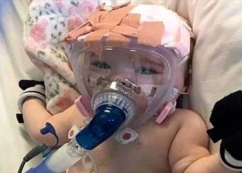 Bebé de seis meses lucha contra el coronavirus conectada a una máquina de oxígeno