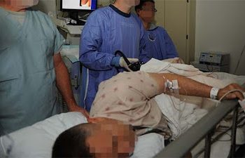 Le sacaron un pepino del ano y dijo que quizá se tragó una semilla