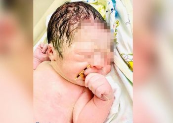 Un bebé nace agarrado al dispositivo anticonceptivo de su madre