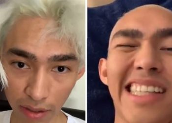 El popular Fernanfloo sufre accidente tras intentar radical cambio de “look”