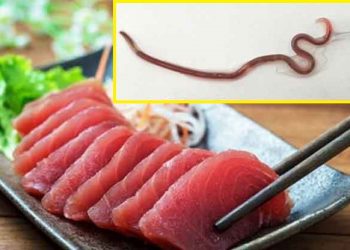 Encuentran un gusano creciendo en la garganta de una mujer quien días antes degustó de un platillo tradicional japonés