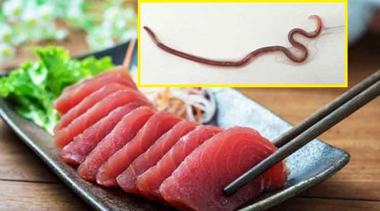 Encuentran un gusano creciendo en la garganta de una mujer quien días antes degustó de un platillo tradicional japonés