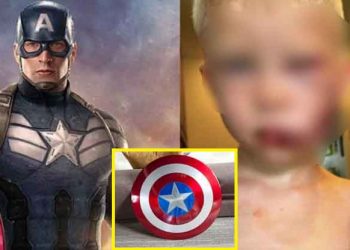 Niño que arriesgó su vida para salvar a su hermanita del ataque de un perro, recibirá el escudo del Capitán América