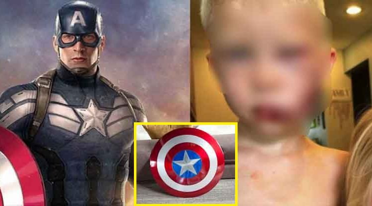 Niño que arriesgó su vida para salvar a su hermanita del ataque de un perro, recibirá el escudo del Capitán América