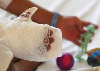 Bebé de año y medio resulta con graves quemaduras en la cocina de su casa