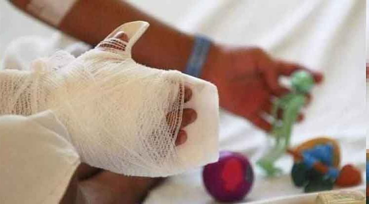 Bebé de año y medio resulta con graves quemaduras en la cocina de su casa