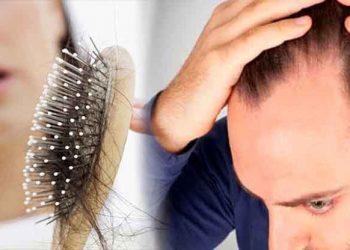 Estudio revela del por qué la carga laboral y estrés están relacionados a la caída del cabello
