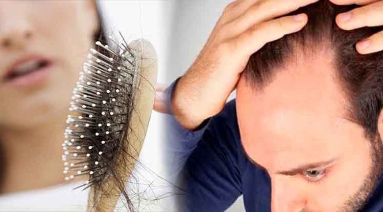 Estudio revela del por qué la carga laboral y estrés están relacionados a la caída del cabello