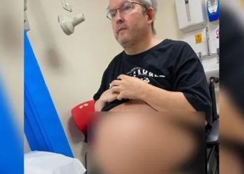 Será operado el hombre con los riñones más grandes del mundo