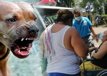 Mujer en Santa Ana es atacada por un pitbull enfurecido y pierde uno de sus dedos pulgares