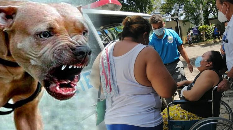 Mujer en Santa Ana es atacada por un pitbull enfurecido y pierde uno de sus dedos pulgares