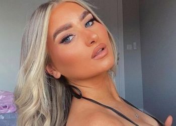 La influencer de 20 años que casi pierde el labio por culpa de un retoque estético