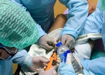 Un joven muere tras sellar su genital con pegamento para evitar que su novia saliera embarazada